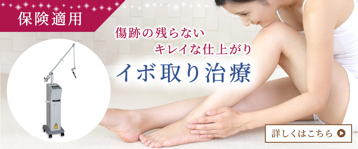 イボ取り治療