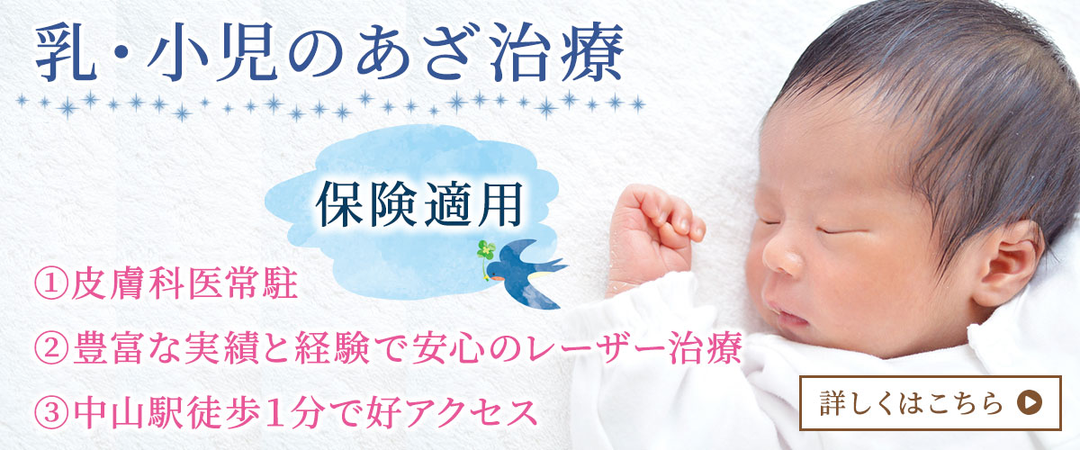 乳・小児のあざ治療